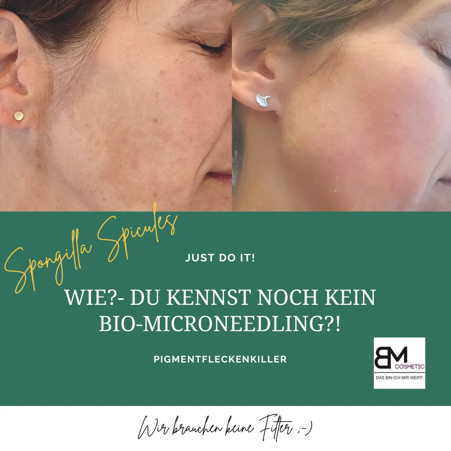 BB-Glow-Behandlung von Beautyconcept